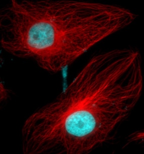 Photon Counting image